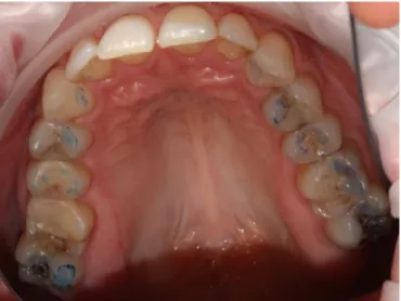 Fig. 36. Vue endo-buccale mandibulaire. 
