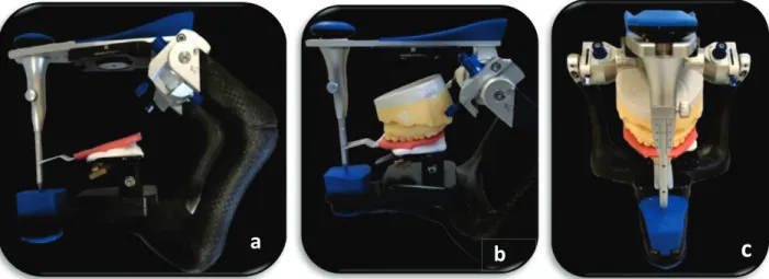 Fig 12.Montage du moulage maxillaire : Le transfert est positionné sur l’articulateur (a) puis le modèle  maxillaire est positionné sur le transfert (b et c).