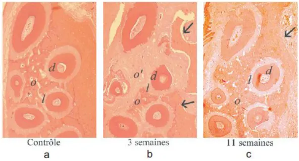 Figure 2: (Dr Sebaoun) Coupes histologiques. À trois semaines (b), importante déminéralisation de l’os  alvéolaire à proximité du site chirurgical indiqué par les flèches, suivi d’un retour à l’état initial après 11 