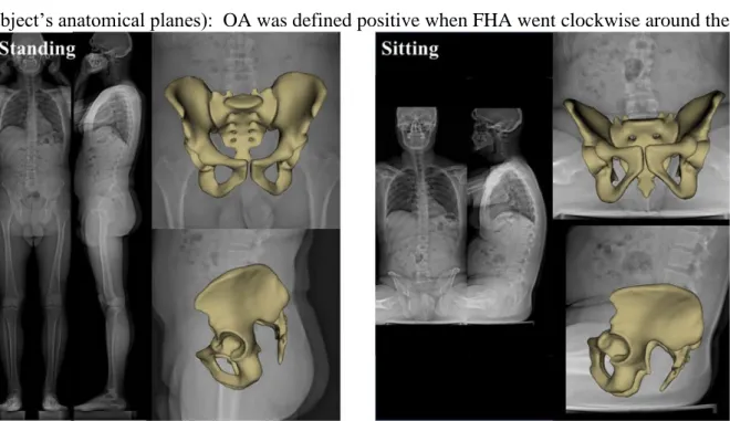 Fig.  1  Frontal  and  lateral EOS  radiographs  with  3D  reconstructions of the  pelvis  in  standing  and  sitting position