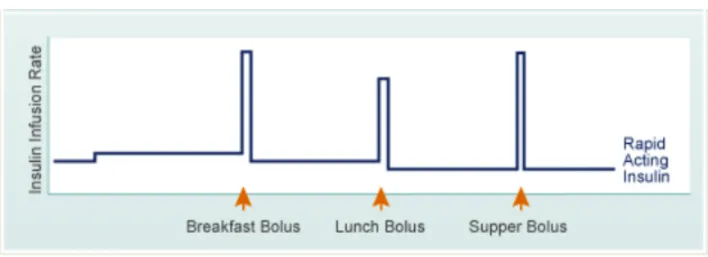 Figure 7 : Schéma insulinique par pompe à insuline : débit de base et bolus 