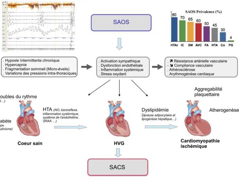 Figure 1 : Physiopathologie de la dysfonction cardiaque dans le syndrome d’apnée du som- som-meil 