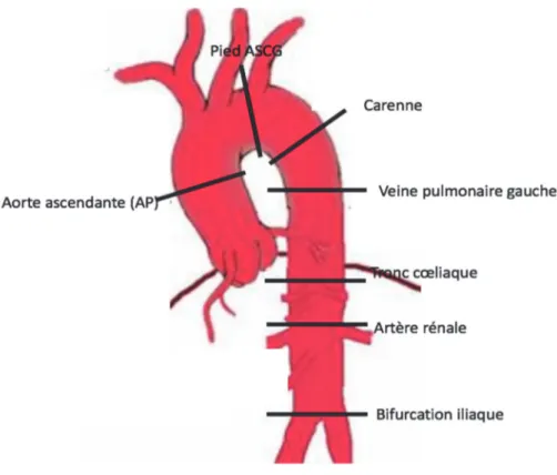 Figure 1 Segmentation aortique 