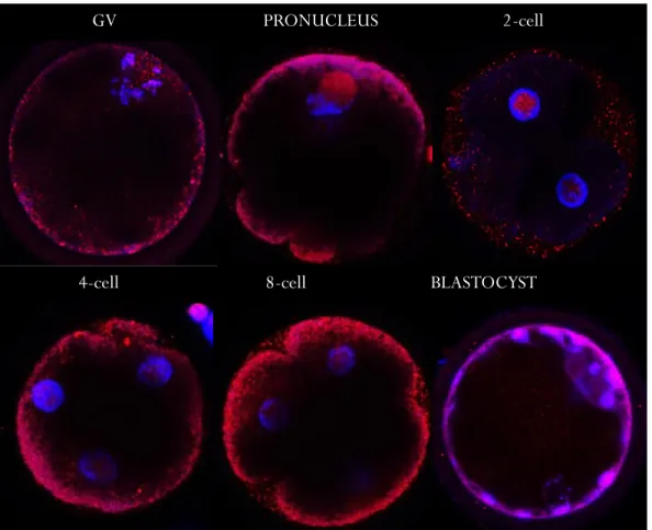 Figure  6.    Immunofluorescence  of  KDM3A  (red)  and  DNA  (blue)  at  different  embryo stages