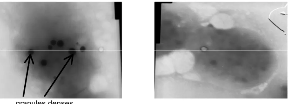 Figure 13 : Visualisation des granules denses par microscopie électronique - technique des whole  mounts - chez un sujet sain (photo de gauche) et chez un patient avec un déficit en granules denses  (photo de droite) 