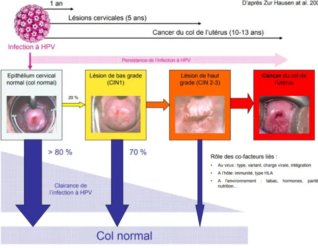 Figure 2 : Histoire naturelle de l’infection à HPV 