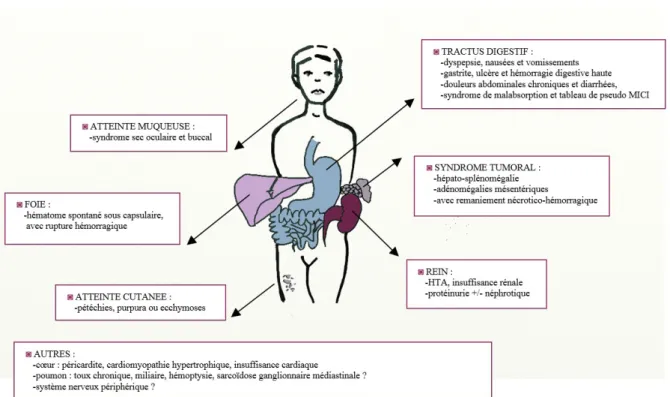 Figure 1 : Différents modes d’expression clinique de l’amylose à lysozyme