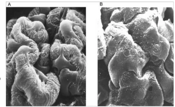 Figure 8: Représentation en microscopie électronique à balayage des fentes de filtration glomérulaire d'un  sujet sain (A) et d'un patient présentant un syndrome néphrotique à lésions glomérulaires minimes (B)   
