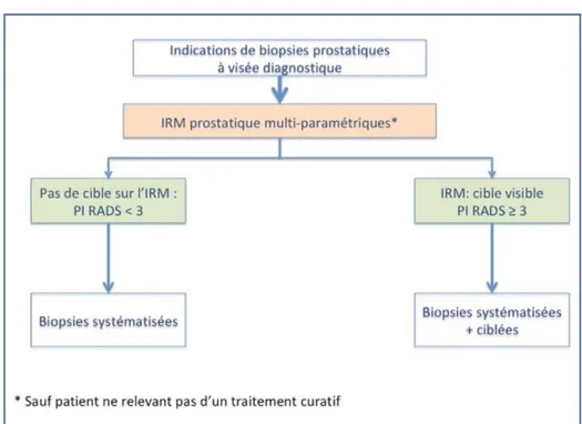 Figure 6 : Recommandations française du CCAFU –2018-2020 –   Stratégie IRM avant biopsie pour la recherche d’un cancer significatif 
