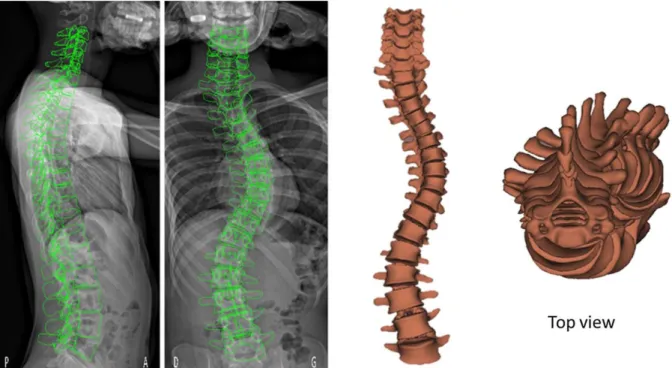 Table 5 reports the mean absolute differences (and standard deviations) of vertebral positions  and  orientation  between  the  current  and  previous  methods,  as  well  as  a  comparison  with  a  recently published 3D  reconstruction algorithm  [19] on