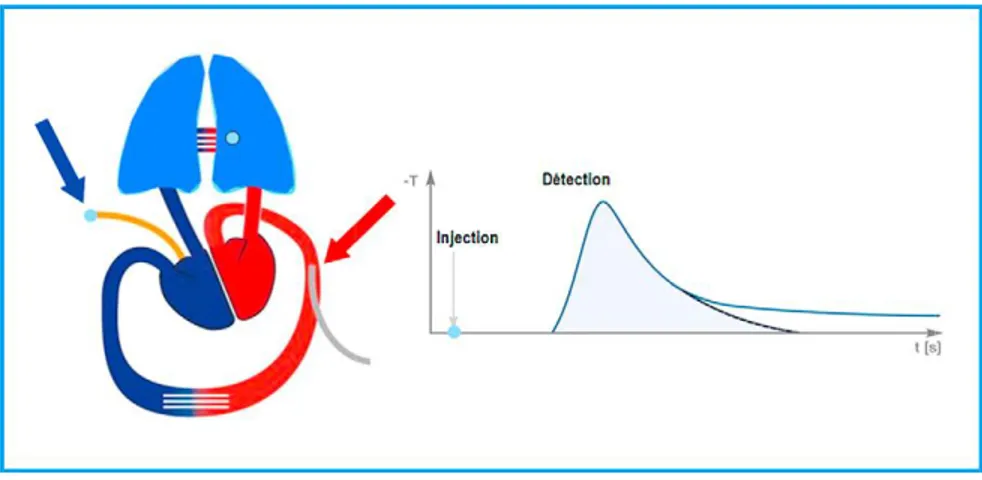 Figure 8. Site d’injection du bolus et de recueil des mesures et courbe de thermodilution 