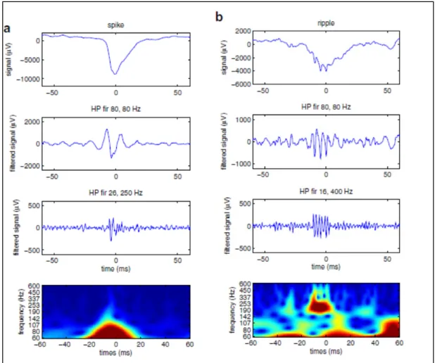 Figure 2.3 Pointe filtrée vs HFO filtré  (a) Effet d’un filtre passe-bande sur une pointe 