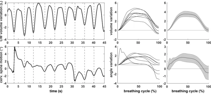 Fig. 2    Left: beginning of each cycle (–); middle: the variation in each signal; right: 95% confidence interval for the signal variations