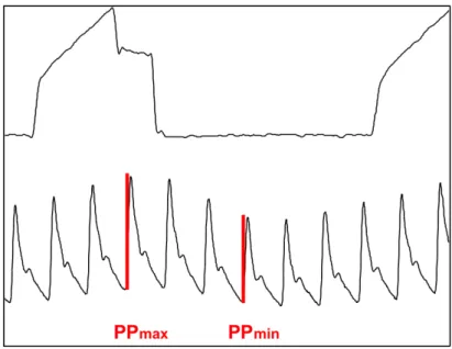 Figure 13 : Variabilité de la PP induite par la ventilation mécanique en mode VAC 
