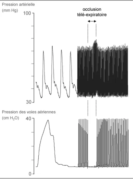 Figure 14 : Principe physiologique du test d'occlusion télé-expiratoire 