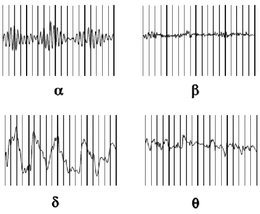 Figure 1. Principaux rythmes de l’EEG 