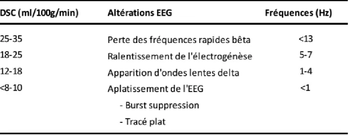 Tableau  1.  Modification  de  L’EEG  en  fonction  des  variations  de  débit  sanguin  cérébrale 