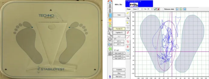 Figure 2. Hardware and software tools for the postural instability measurement 