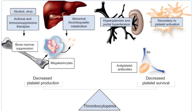 Figure 1 : Mécanismes responsables de la thrombopénie chez le patient cirrhotique. D’après  Violi et al