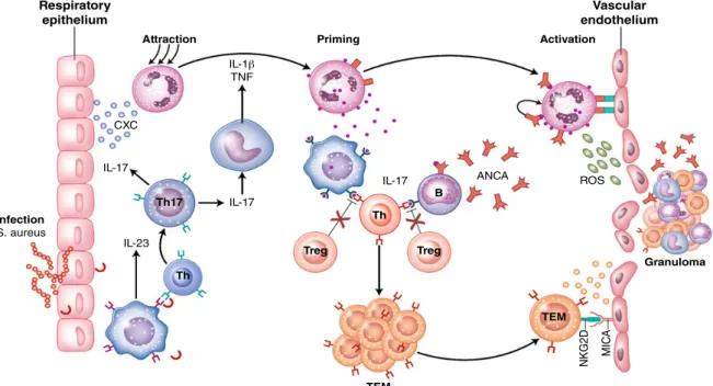 Fig 1 A proposed model representing innate and adaptive immune mechanisms supposedly involved in the pathogenesis of antineutrophil cytoplasmic autoantibody (ANCA)-associated systemic vasculitis.