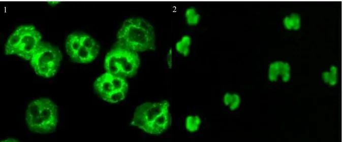 Figure 5: Aspect des ANCA à l’immunofluorescence indirecte sur cellules HEp-2 (34) 