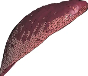 Fig. 18 Difference in the predicted displacement for a particular load position between the interpolated and the reference livers