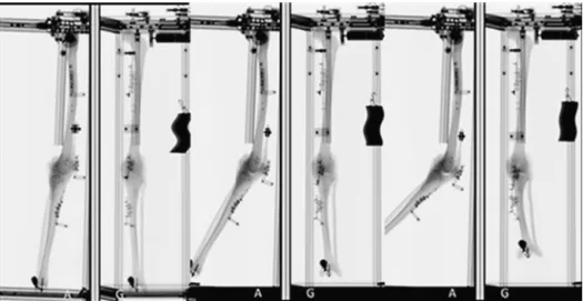 Fig. 1. In vitro views in extension pose, in 20 ◦ and 40 ◦ flexion poses. Cluster markers in each bone are also identifiable.