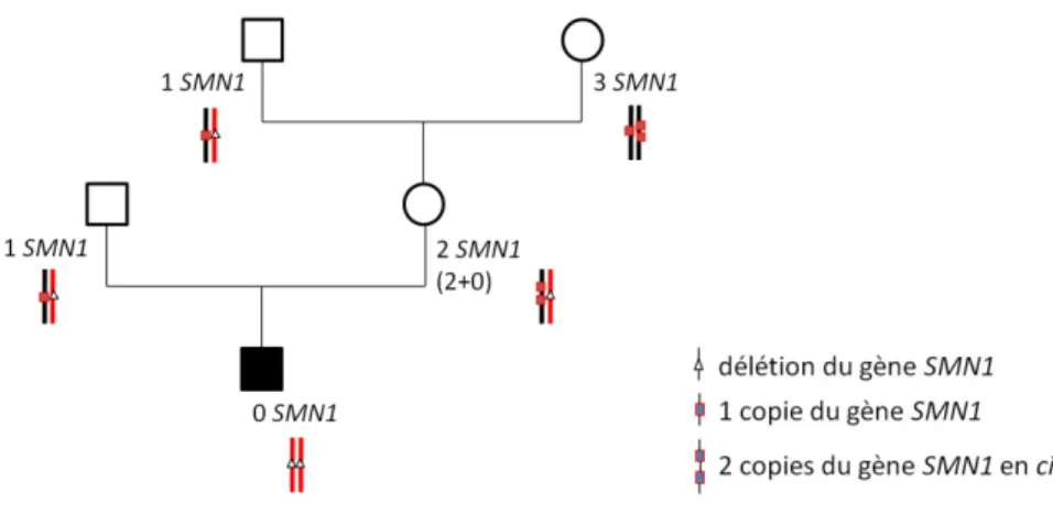 Figure 4 : Exemple d'un parent  de cas-index 2T avec grands-parents 1T et 3T 