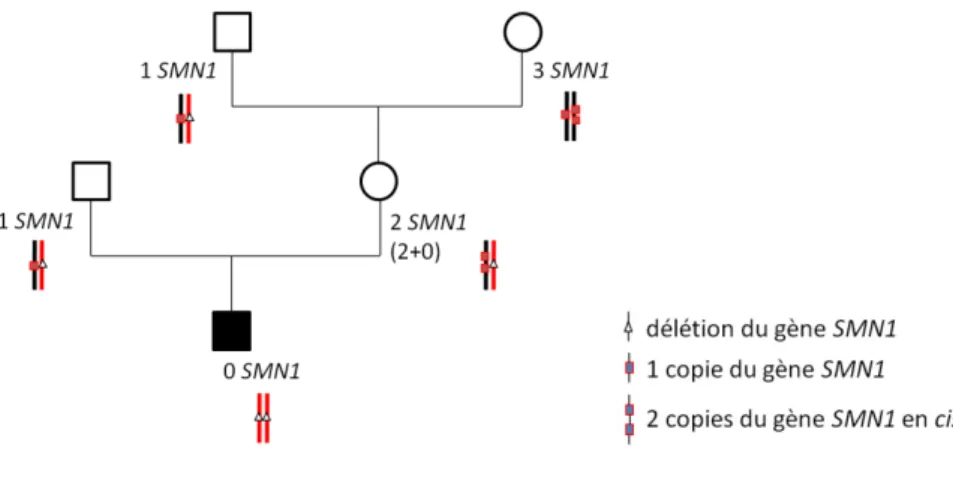 Figure 6 : Exemple d'un parent  de cas-index 2T avec grands-parents 1T et 3T 