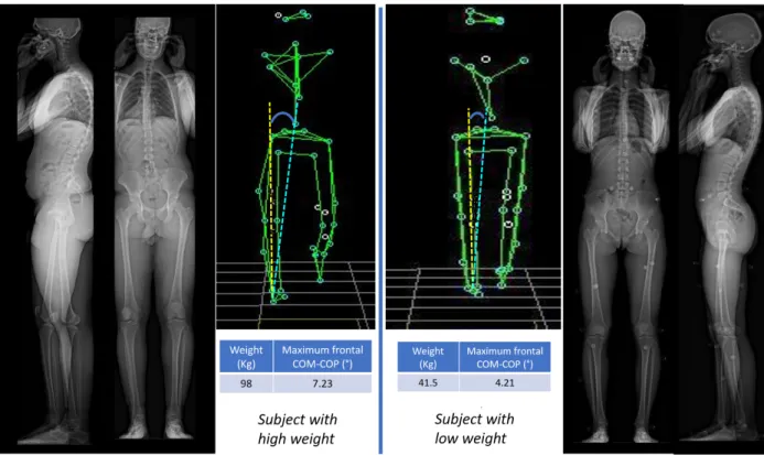 Fig. 7. Example of the maximum frontal COM-COP angle in two subjects with diﬀerent weights.