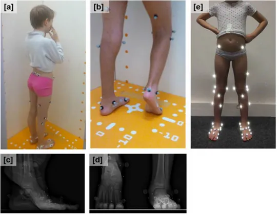 Table 1 and Fig. 2 show the radiological parameters.