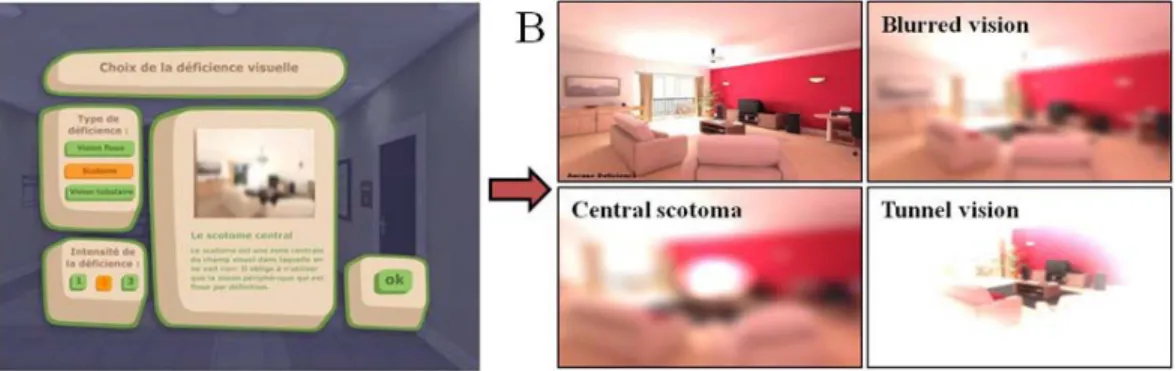 Figure 1. A snapshot of the virtual environment fonctionalities. (A) Through a menu, users can choose form and intensity of  low  vision  displayed  (on  the  left);  and  concurrently  inform  about  the  selected  form  (on  the  right);  (B)  results  o