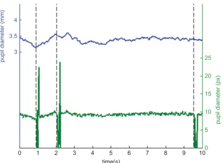 FIG. 2. Pupil output in mm (top line, left-hand scale) and px (bottom line, right-hand scale)