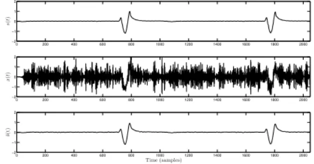 Fig. 6 . ECG signal (original, noisy and denoised).