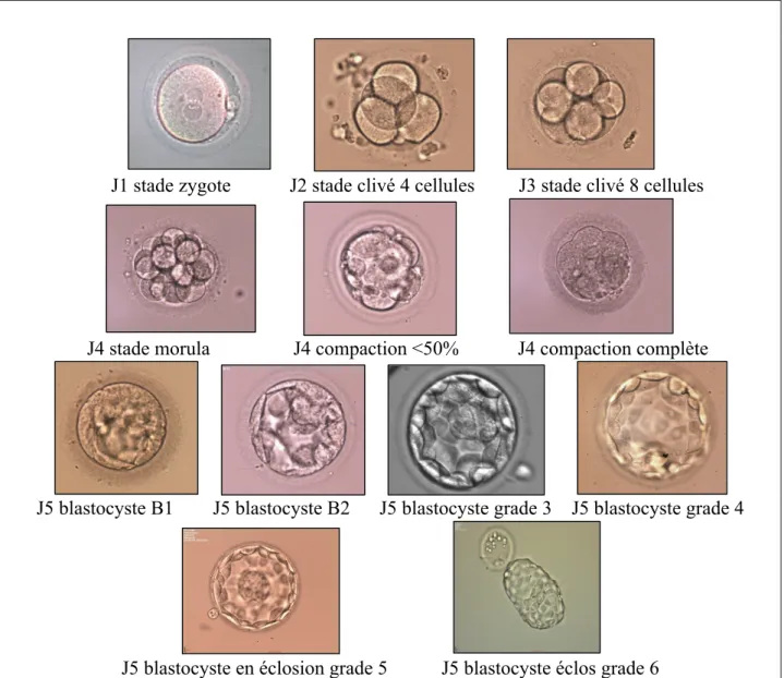 Figure 1 : Stades de développement précoce de l’embryon. Images d’embryons obtenus dans le service de Biologie  de la Reproduction du Pr Hamamah au CHU Arnaud de Villeneuve de Montpellier  