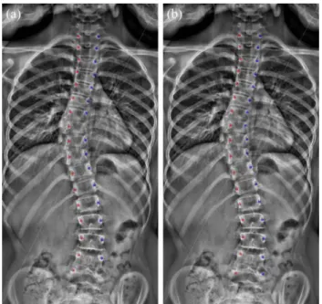 Table 2    Average values of  vertebrae width-to-depth (w/2d)  ratios (in mm) from T1 to L5