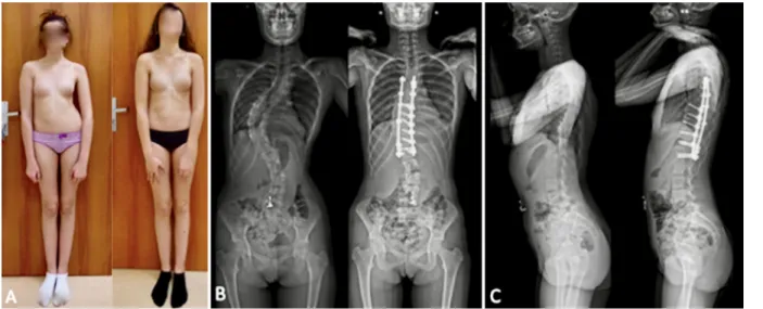 FIG. 5. A: Prediction based on the observed clinical height gain for the validation population