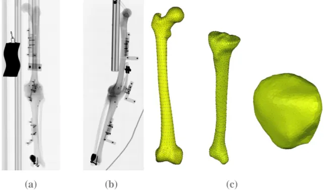 Figure 2: An example of radiograph in (a) frontal, (b) sagittal view and its (c) 3D reconstruction model of  femur, tibia and patella 