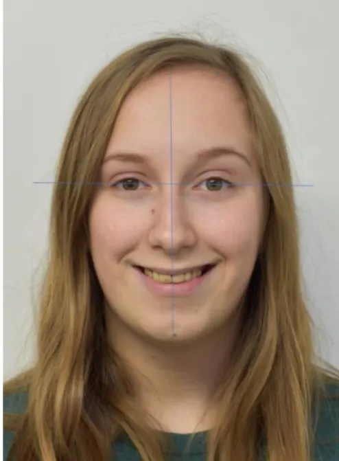 Figure 8 : Analyse du visage de face 