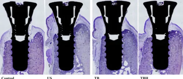 Figure 10 : Coupes histologiques (x40) à 3 mois post chirurgie. 