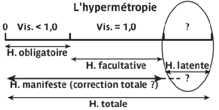 Figure : L’hypermétropie. 