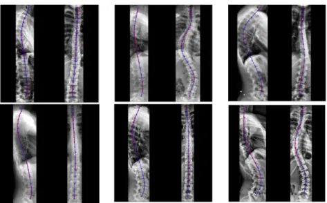 Table 2 reports RMSE (mm) values from the frontal views and Table 3 from the  sagittal views