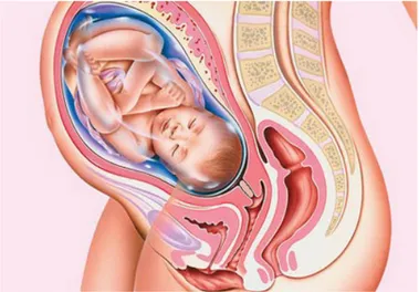Figure 5: Foetus dans l'utérus, à terme