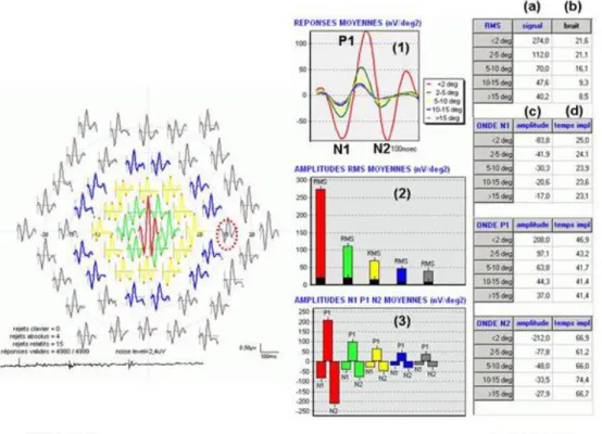 Figure    V-­‐5-­‐9.    Analyse    de    l’ERG    multifocal    de    la    figure    V-­‐5-­‐8