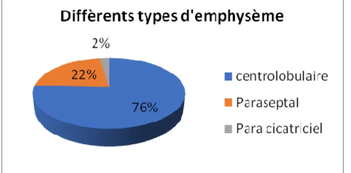 Figure 7 : Répartition des différents types d’emphysème rencontrés chez les patients inclus