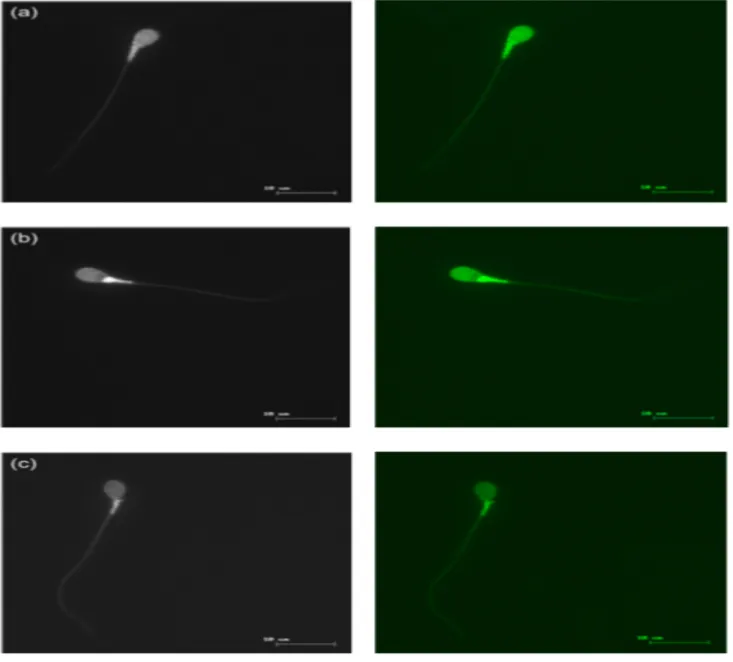 Figure  8  :  Localisation  de  la  fluorescence  de  la  chlortetracycline  (CTC)  chez  le  spermatozoïde humain
