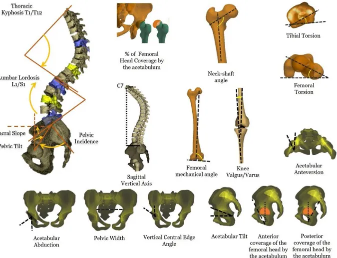 Fig. 1. Subject-speciﬁc skeletal parameters calculated from 3D reconstructions based on biplanar X-rays.