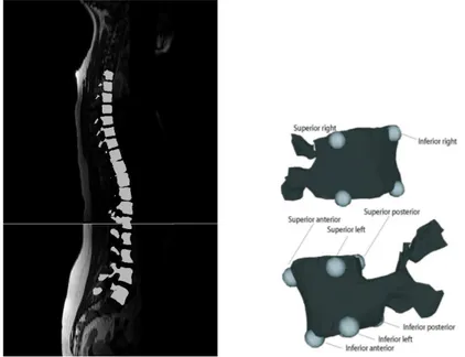 Fig. 1. 3D reconstruction of vertebrae from MRI sagittal slices along with manually labeled correspondences on each of the vertebrae.