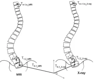 Fig. 2. Local and global transformations forming the articulated model required to align MRI onto X-ray vertebrae.