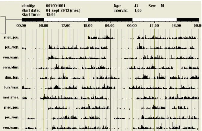 Fig 6. Exemple d’actogramme    